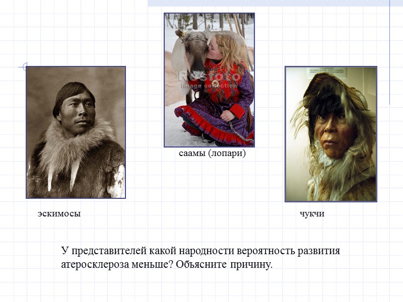 У представителей какой народности вероятность развития атеросклероза меньше? Объясните причину. эскимосы саамы (лопари) чукчи